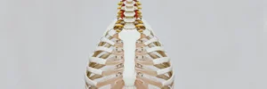 What is a Cervical Rib?