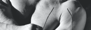 Pectoralis Minor Syndrome vs Thoracic Outlet Syndrome