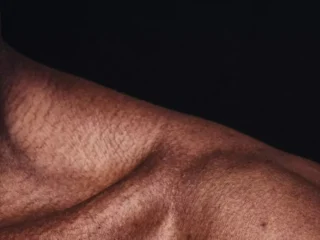 {{brizy_dc_image_alt entityId=